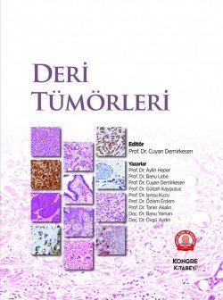 Deri Tümörleri