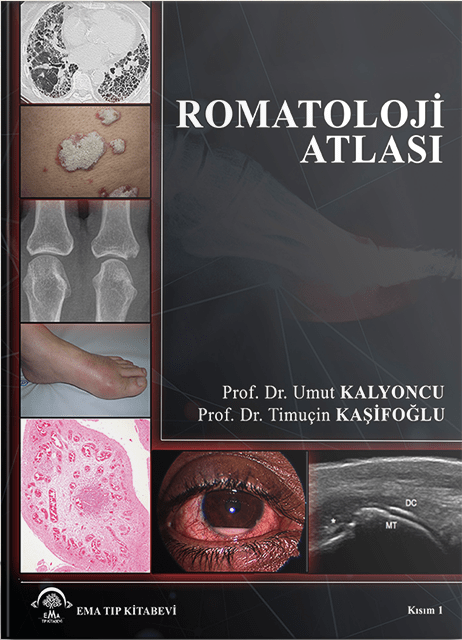 Romatoloji Atlası