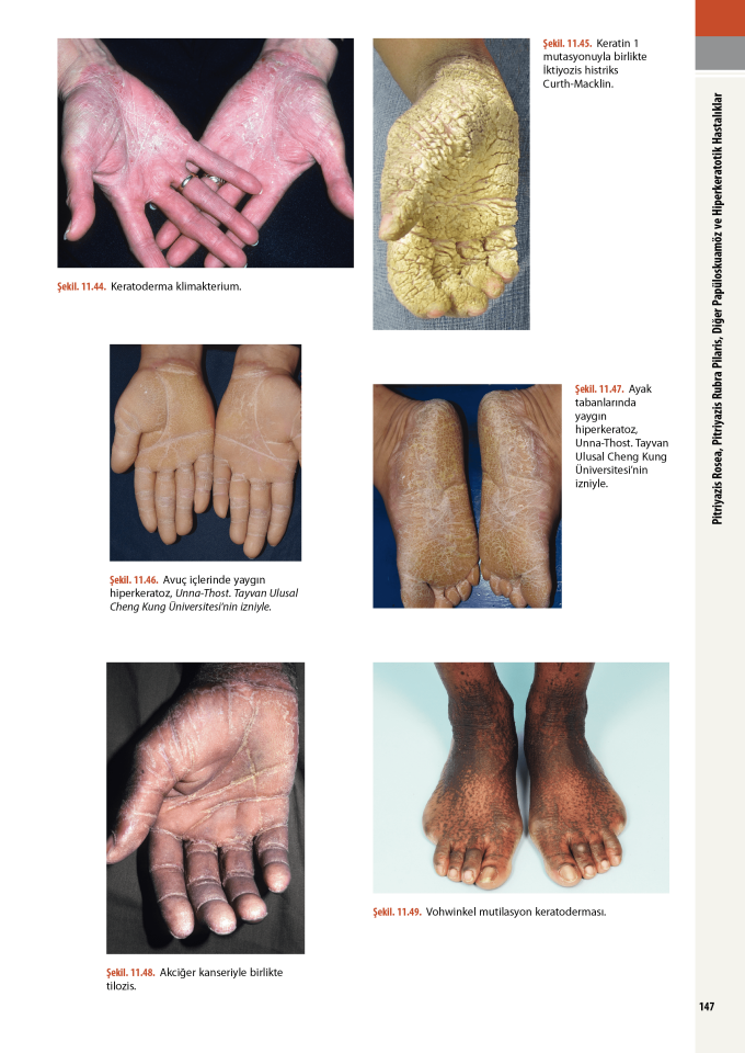 Andrews Dermatoloji Atlası ÖN SİPARİŞ