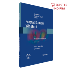 Prostat Kanseri Yönetimi