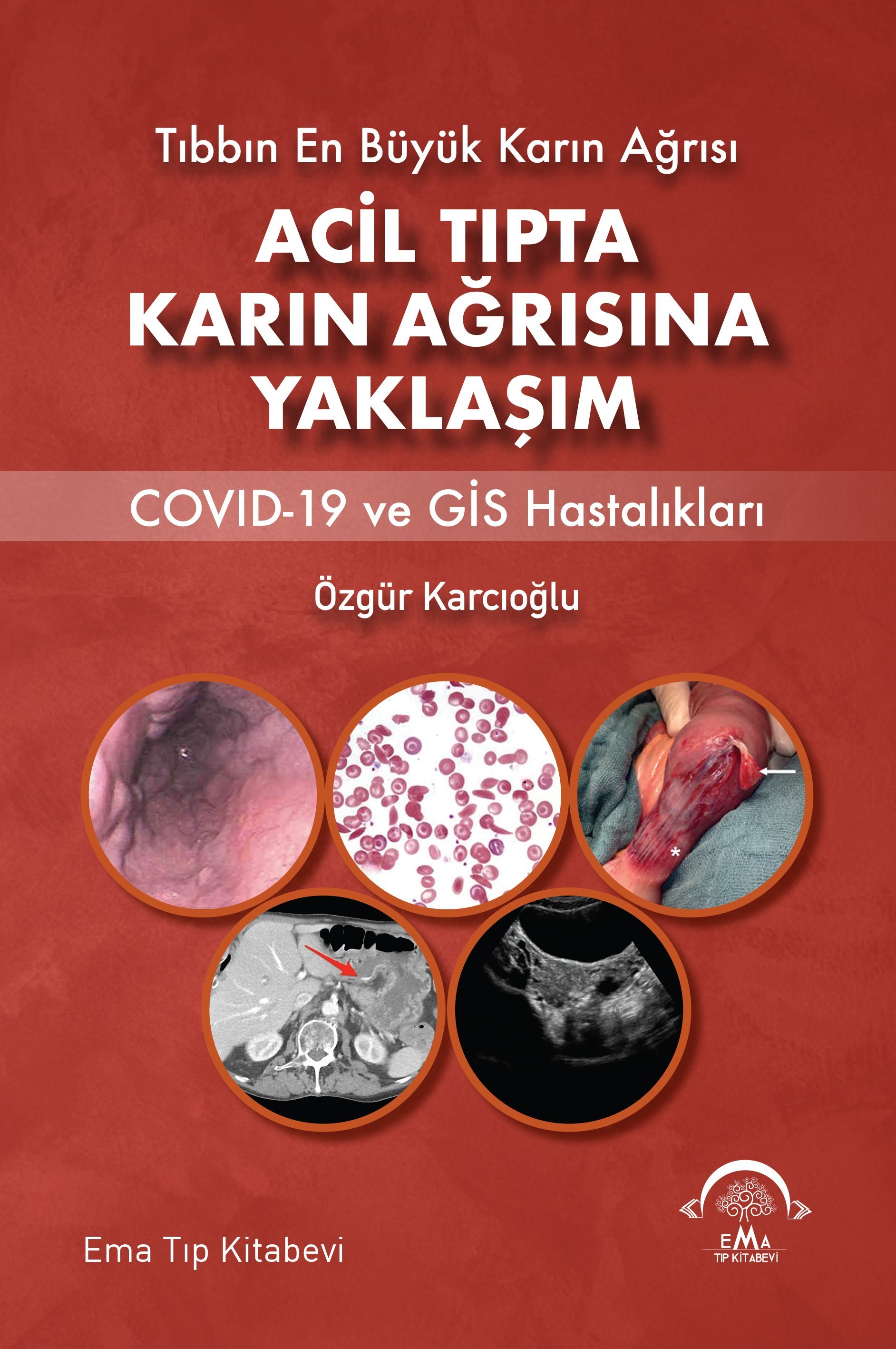 Acil Tıpta Karın Ağrısına Yaklaşım
