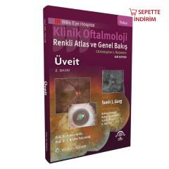 Klinik Oftalmoloji Renkli Atlas ve Genel Bakış - ÜVEİT