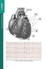 Hastane Öncesi Acil Bakımda EKG ve İleri Yaşam Desteği Uygulamaları
