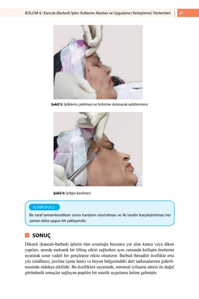 Dermatolojide İp Askılama