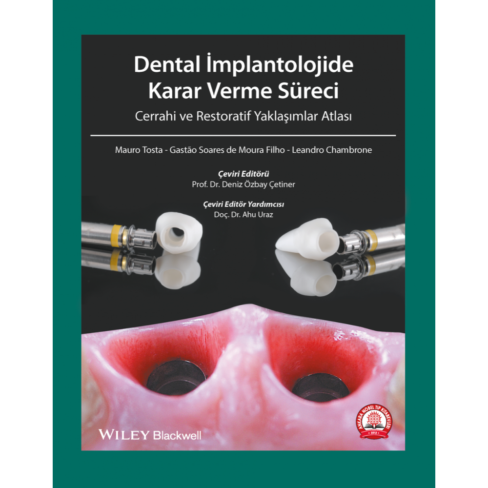 Dental İmplantolojide Karar Verme Süreci Cerrahi ve Restoratif Yaklaşımlar Atlası