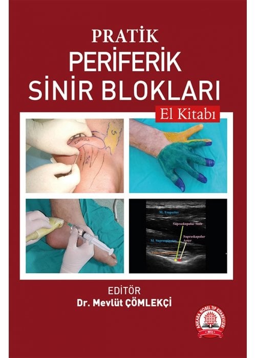 Pratik Periferik Sinir Blokları El Kitabı