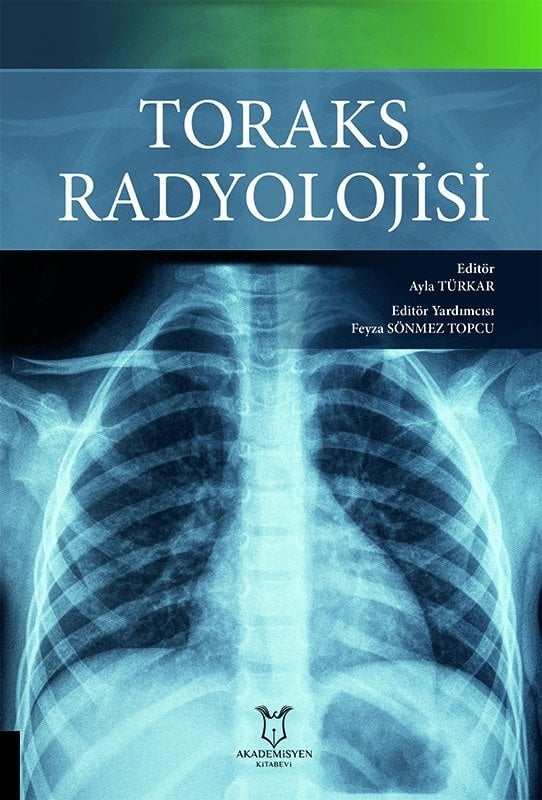 Toraks Radyolojisi