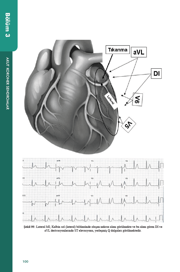 Hastane Öncesi Acil Bakımda EKG ve İleri Yaşam Desteği Uygulamaları