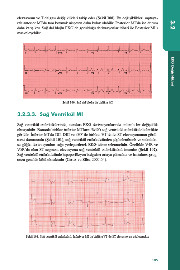 Hastane Öncesi Acil Bakımda EKG ve İleri Yaşam Desteği Uygulamaları
