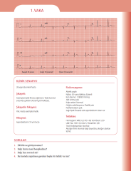 EKG'yi Anlamak (Kendinizi Değerlendirmek İçin Vakalar)