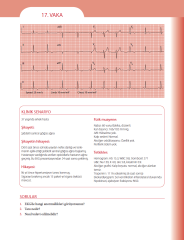 EKG'yi Anlamak (Kendinizi Değerlendirmek İçin Vakalar)