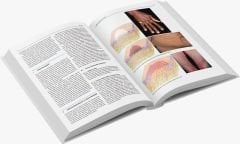 Braun-Falco Dermatoloji Cilt 1-2