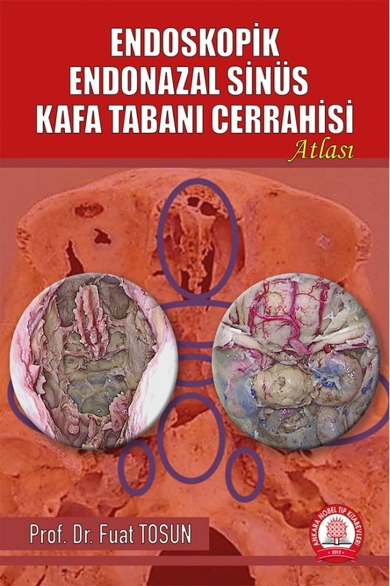 Endoskopik Endonazal Sinüs Kafa Tabanı Cerrahisi