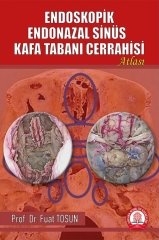 Endoskopik Endonazal Sinüs Kafa Tabanı Cerrahisi