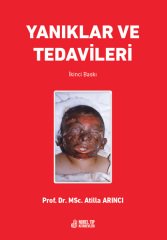 Yanıklar ve Tedavileri