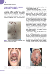 Alerji ve İmmünoloji Hastalıkları Güncel Tanı ve Tedavi
