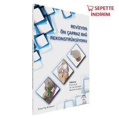 Revizyon Ön Çapraz Bağ Rekonstrüksiyonu