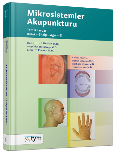 Mikrosistemler Akupunkturu