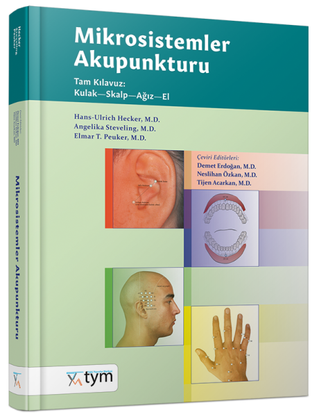 Mikrosistemler Akupunkturu