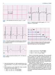 Pediatrik EKG