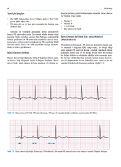 Pediatrik EKG