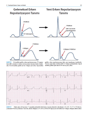 Pediatrik EKG