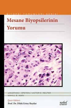 Mesane Biyopsilerinin Yorumu - Biyopsi Yorumları Serisi