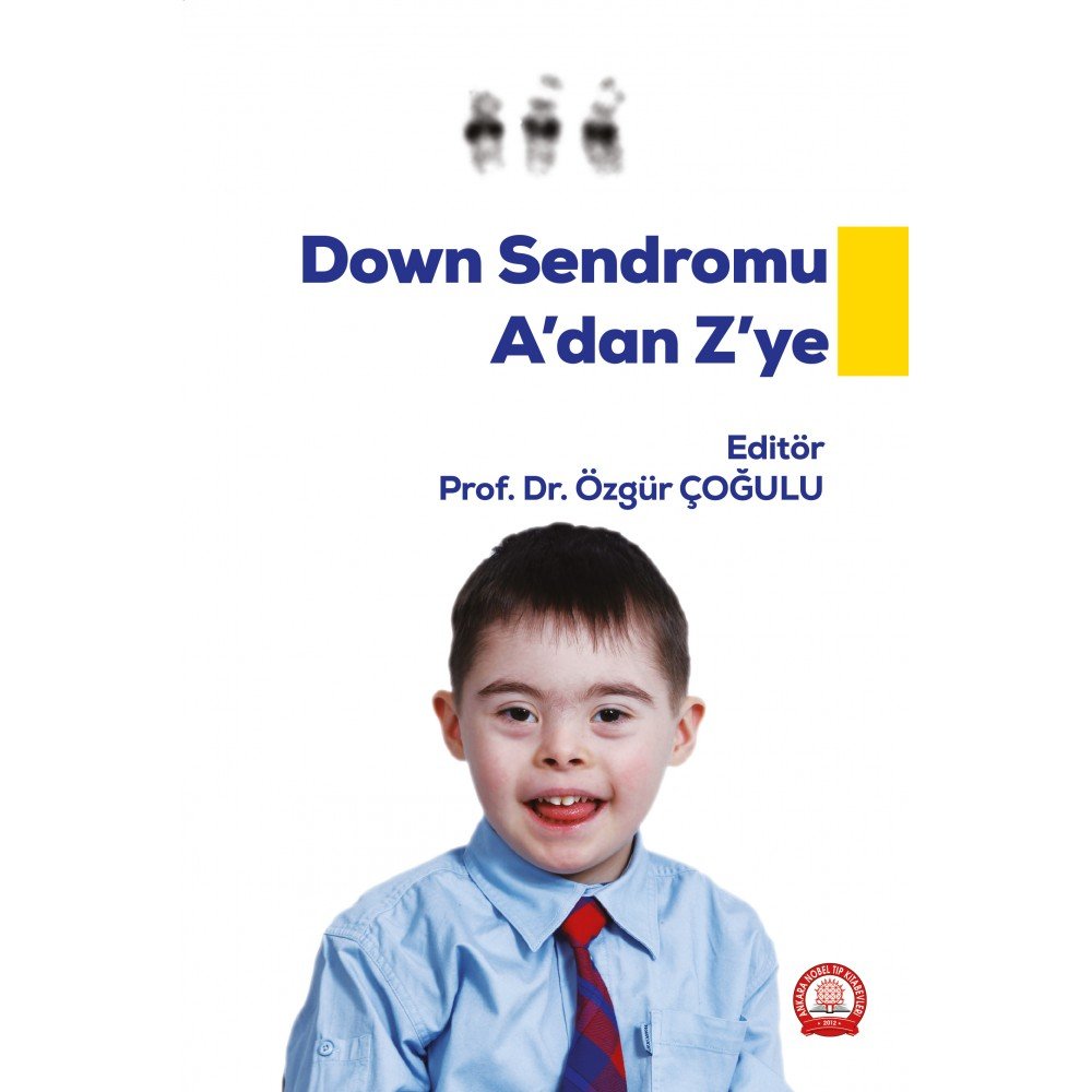 Down Sendromu A dan Z ye