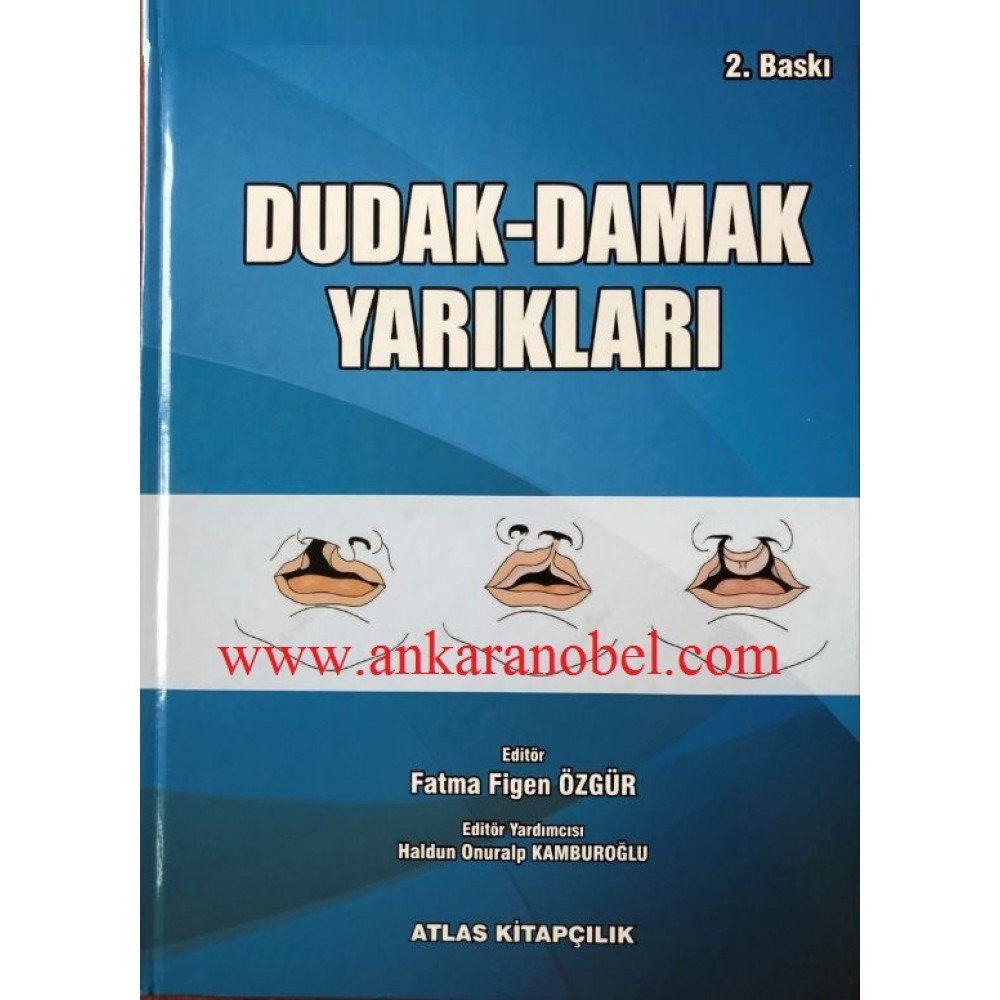 Dudak Damak Yarıkları