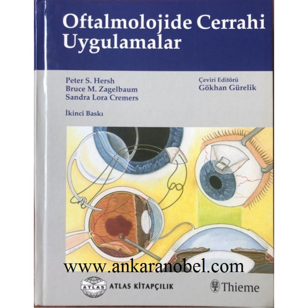 Oftalmolojide Cerrahi Uygulamalar