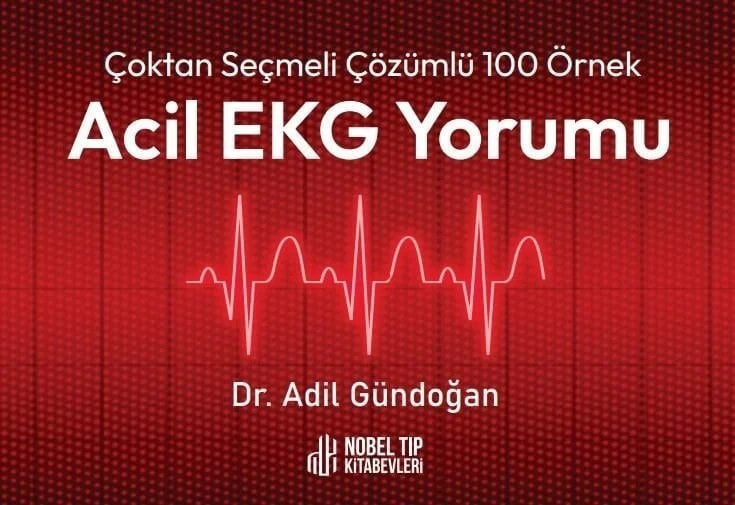 Çoktan Seçmeli Çözümlü 100 Örnek Acil EKG Yorumu