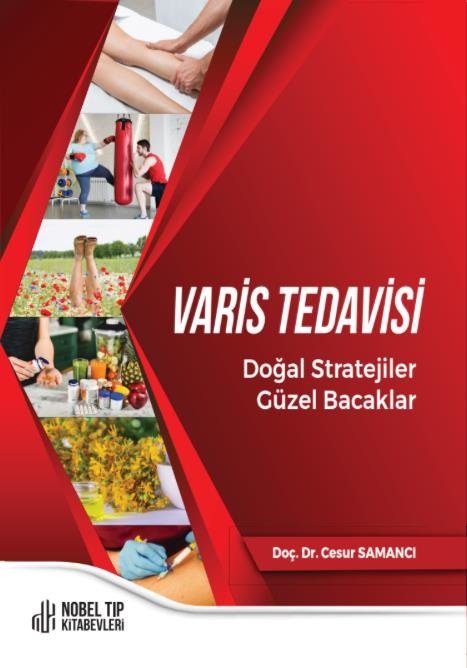 Varis Tedavisi Doğal Stratejiler,Güzel Bacaklar