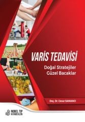 Varis Tedavisi Doğal Stratejiler,Güzel Bacaklar