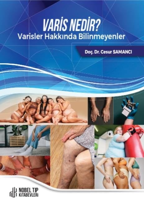 Varis Nedir ? Varisler Hakkında Bilinmeyenler