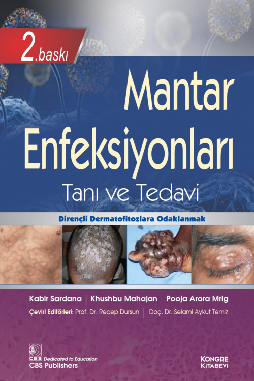 Mantar Enfeksiyonları Tanı ve Tedavi