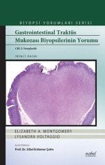 Gastrointestinal Traktüs Mukozası Biyopsilerinin Yorumu Cilt 2: Neoplastik - Biyopsi Yorumları Serisi