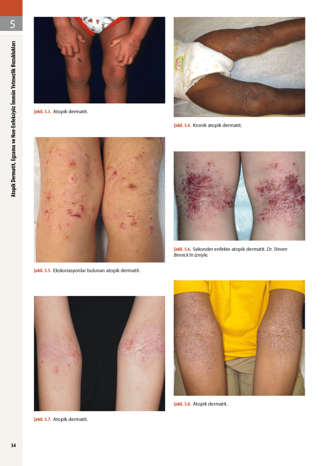 Andrews Dermatoloji Atlası ÖN SİPARİŞ