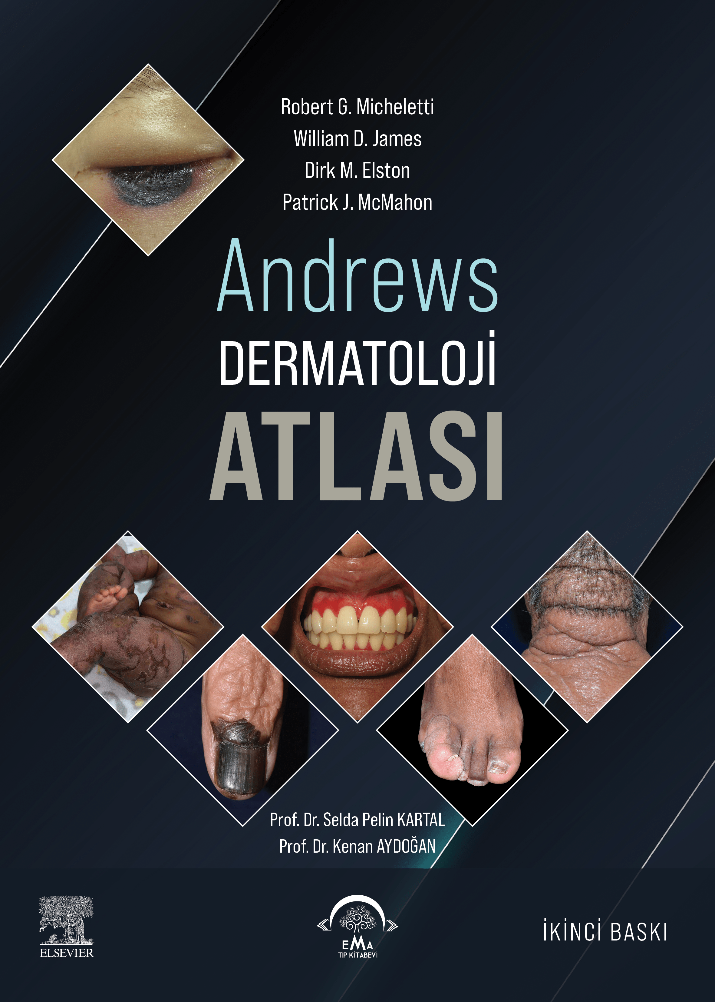 Andrews Dermatoloji Atlası ÖN SİPARİŞ