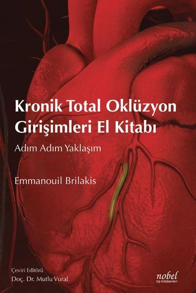 Kronik Total Oklüzyon Girişimleri El Kitabı: Adım Adım Yaklaşım
