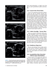 Fiziksel Tıp ve Rehabilitasyonda Kas İskelet Sistemi Ultrasonografisi
