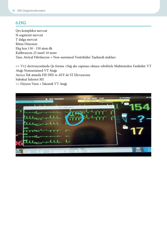 EKG Yorumlama Rehberi
