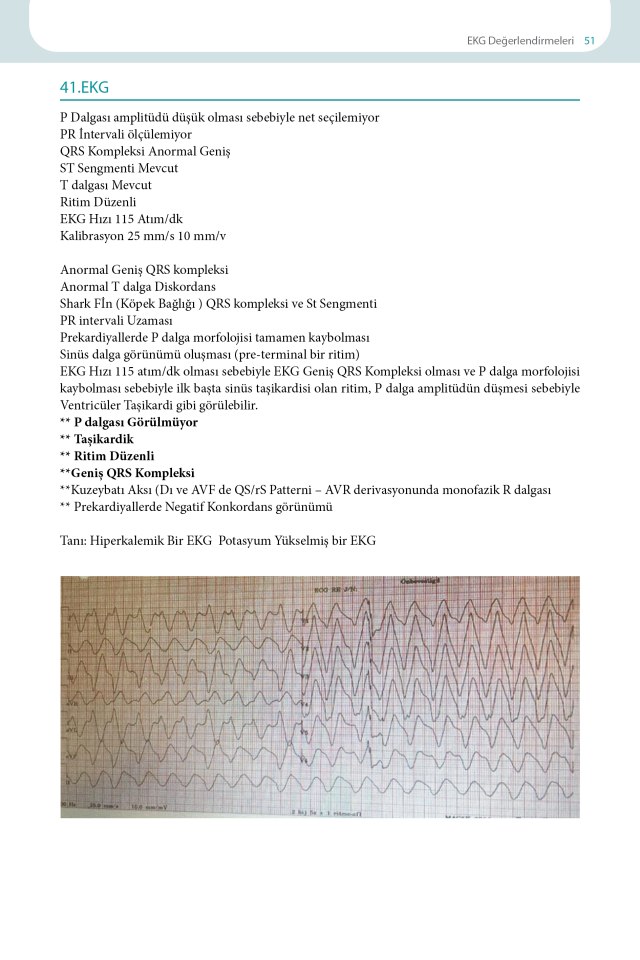 EKG Yorumlama Rehberi