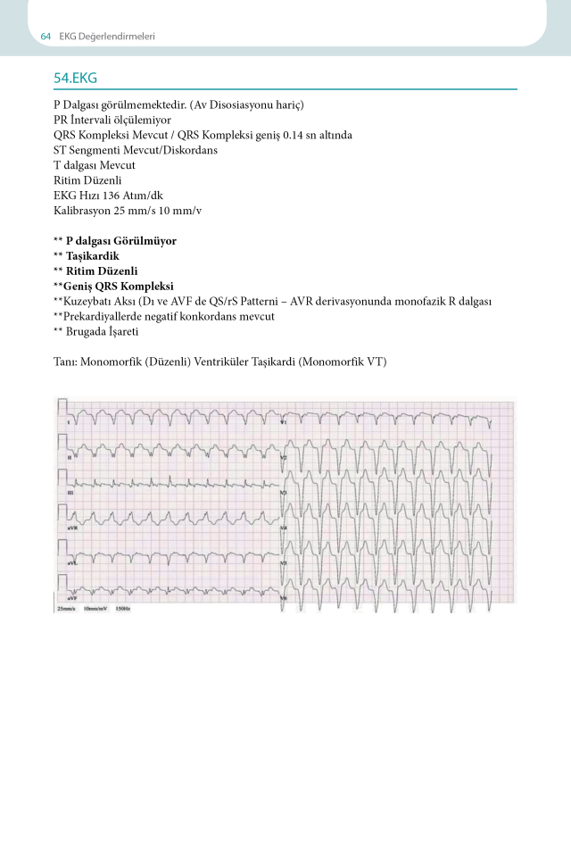 EKG Yorumlama Rehberi