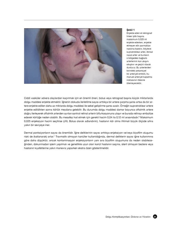 Dolgu Komplikasyonları: Önleme ve Yönetim Videolu Kitap