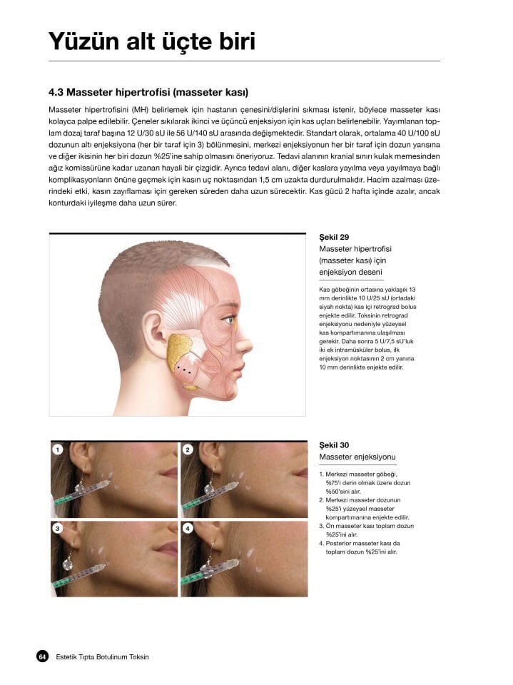Botoks Estetik Tıpta Botulinum Toksin: Enjeksiyon Protokolleri ve Komplikasyon Yönetimi Videolu Kitap