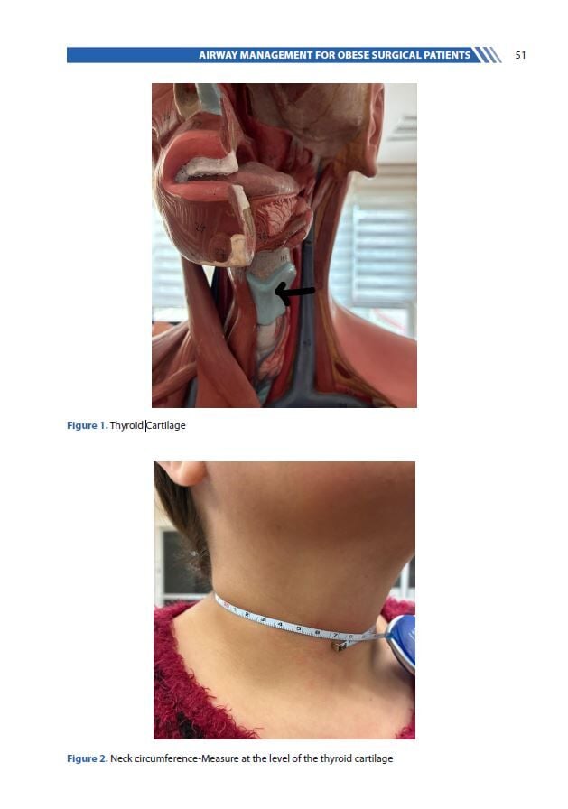 Obesity: Perioperative Management