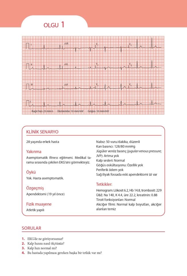 EKG’yi Anlamak Kendinizi Değerlendirmek İçin Vakalar