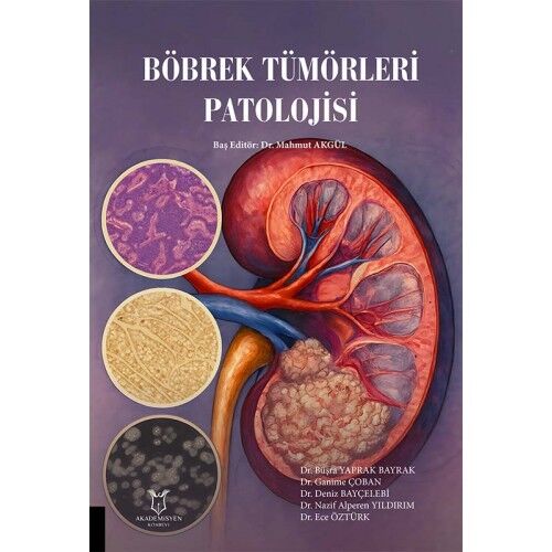 Böbrek Tümörleri Patolojisi