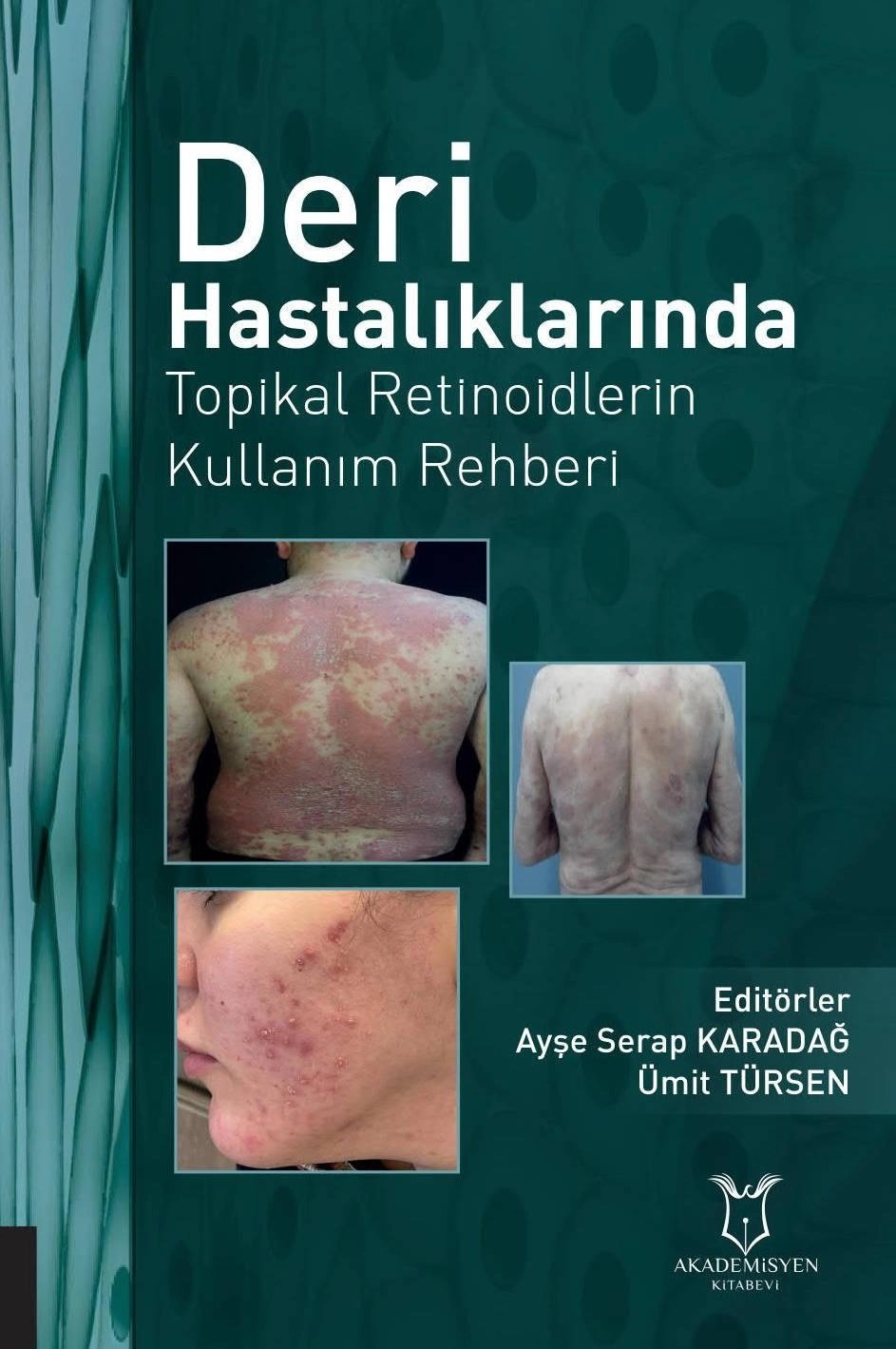 Deri Hastalıklarında Topikal Retinoidlerin Kullanım Rehberi