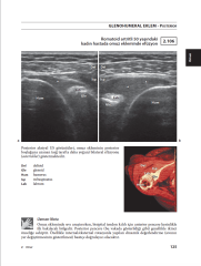 Sık Görülen Kas İskelet Sistemi Hastalıkları için Ultrasonografik Atlas